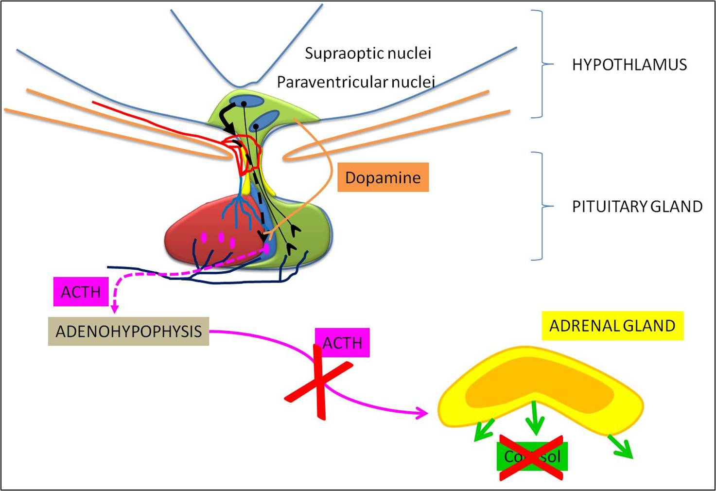 Effet de la dopamine sur la sécrétion d'ACTH par l'hypophyse